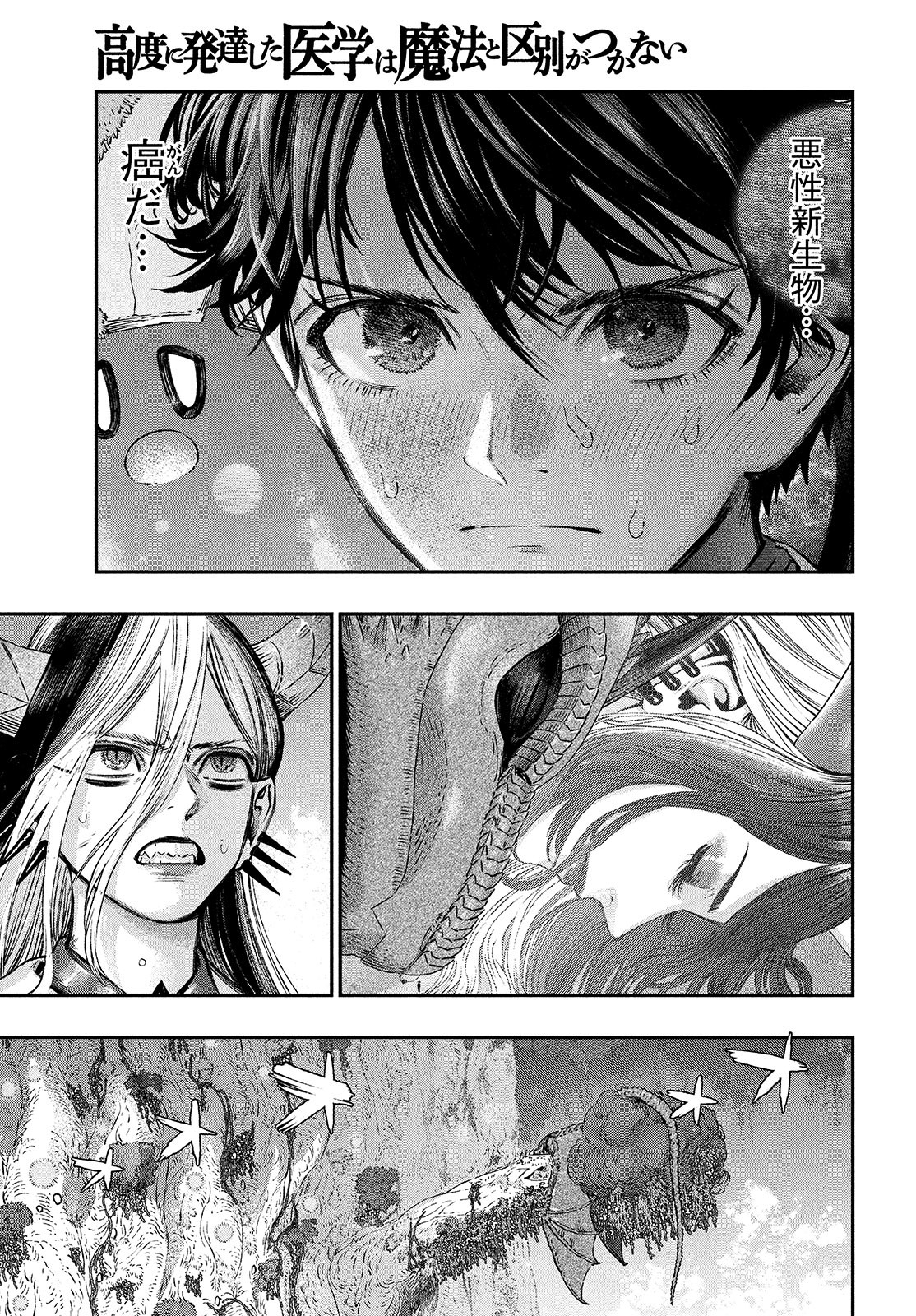 に発達した医学は魔法と区別がつかない Chap 8 - Next Chap 9