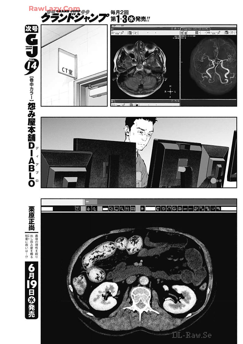 ラジエーションハウス Chap 137 - Next Chap 138