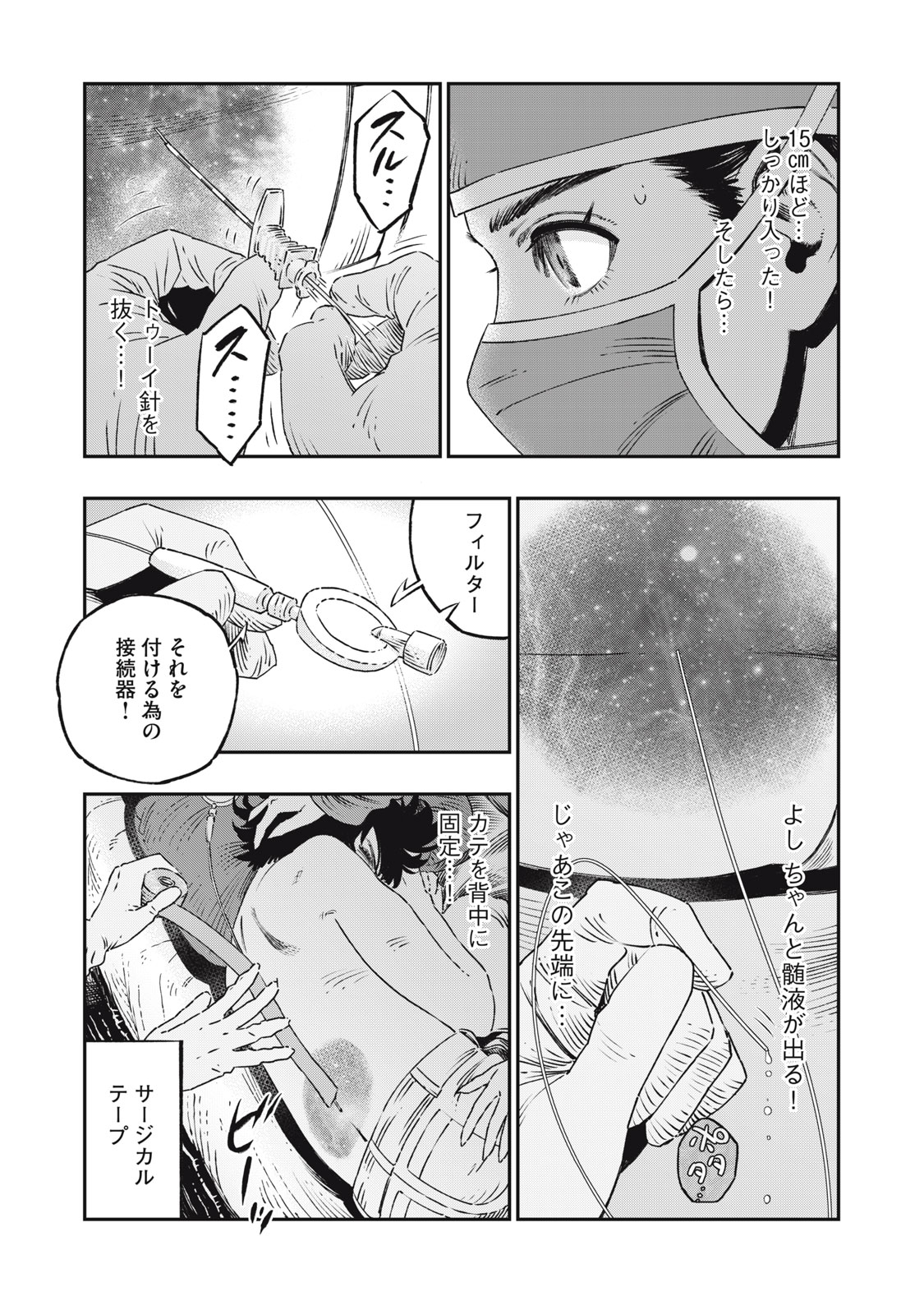 に発達した医学は魔法と区別がつかない Chap 17.1 - Next Chap 18.1