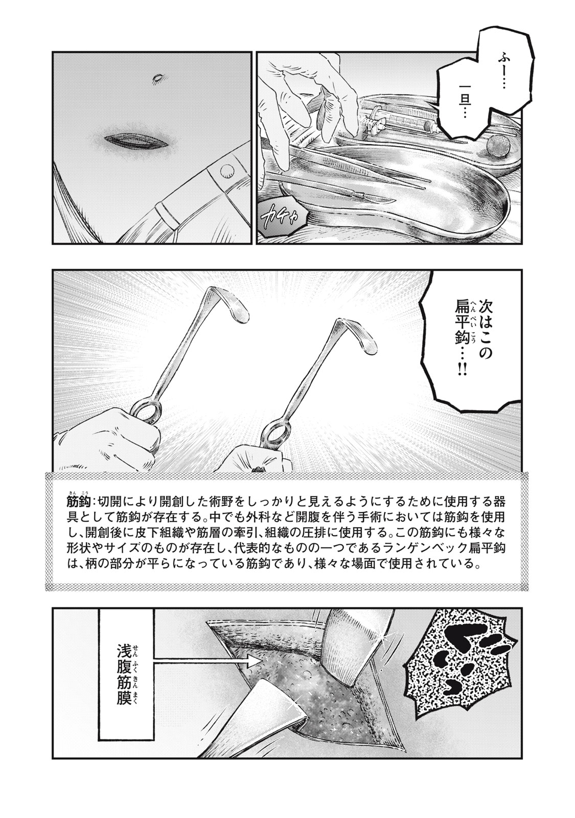 に発達した医学は魔法と区別がつかない Chap 17.2 - Next Chap 18.2