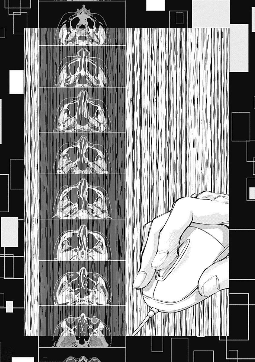 ラジエーションハウス Chap 35 - Next Chap 36