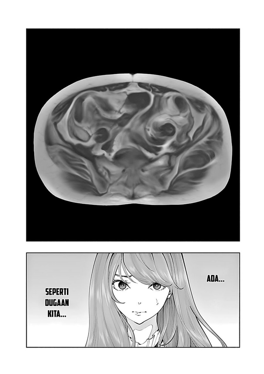 Radiation House Chap 67 - Next Chap 68